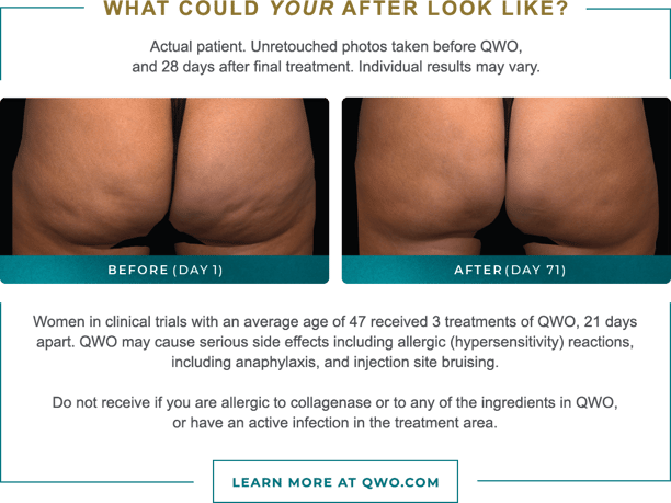 05289-before-after-desktop-2