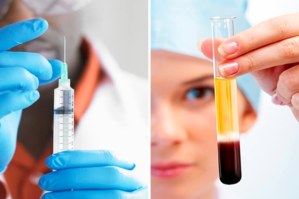 WHAT IS A PRP VAMPIRE FACELIFT 2 liquivida lounge.jpg
