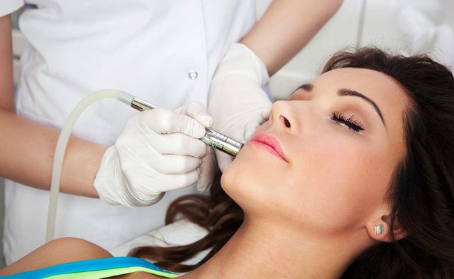 What is Microdermabrasion liquivida lounge