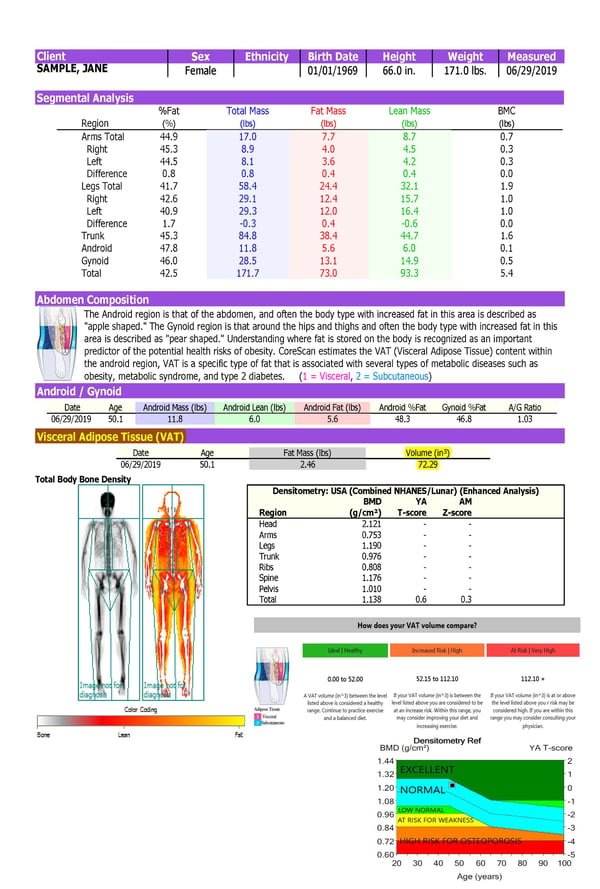 DXA Body Scans