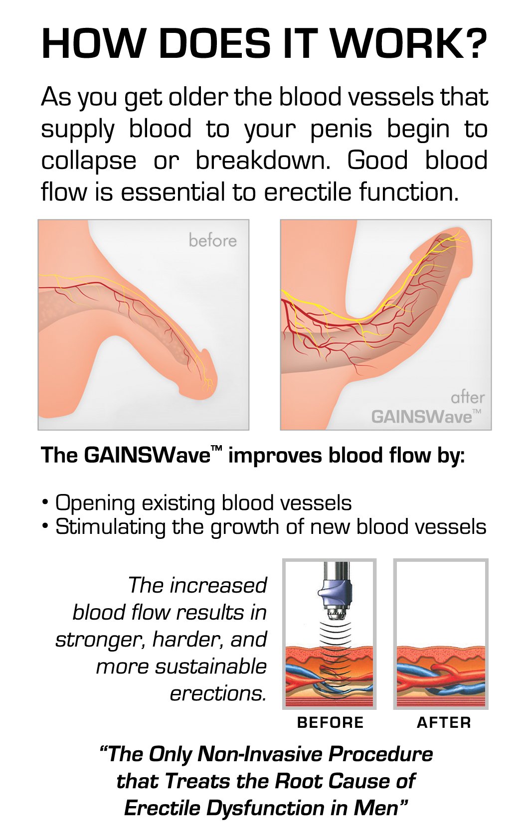 Gainswave Liquivida Lounge