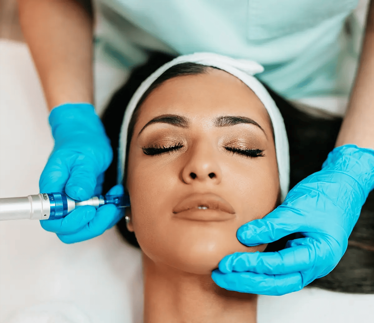 Relaxed woman during a Microneedling session at Liquivida