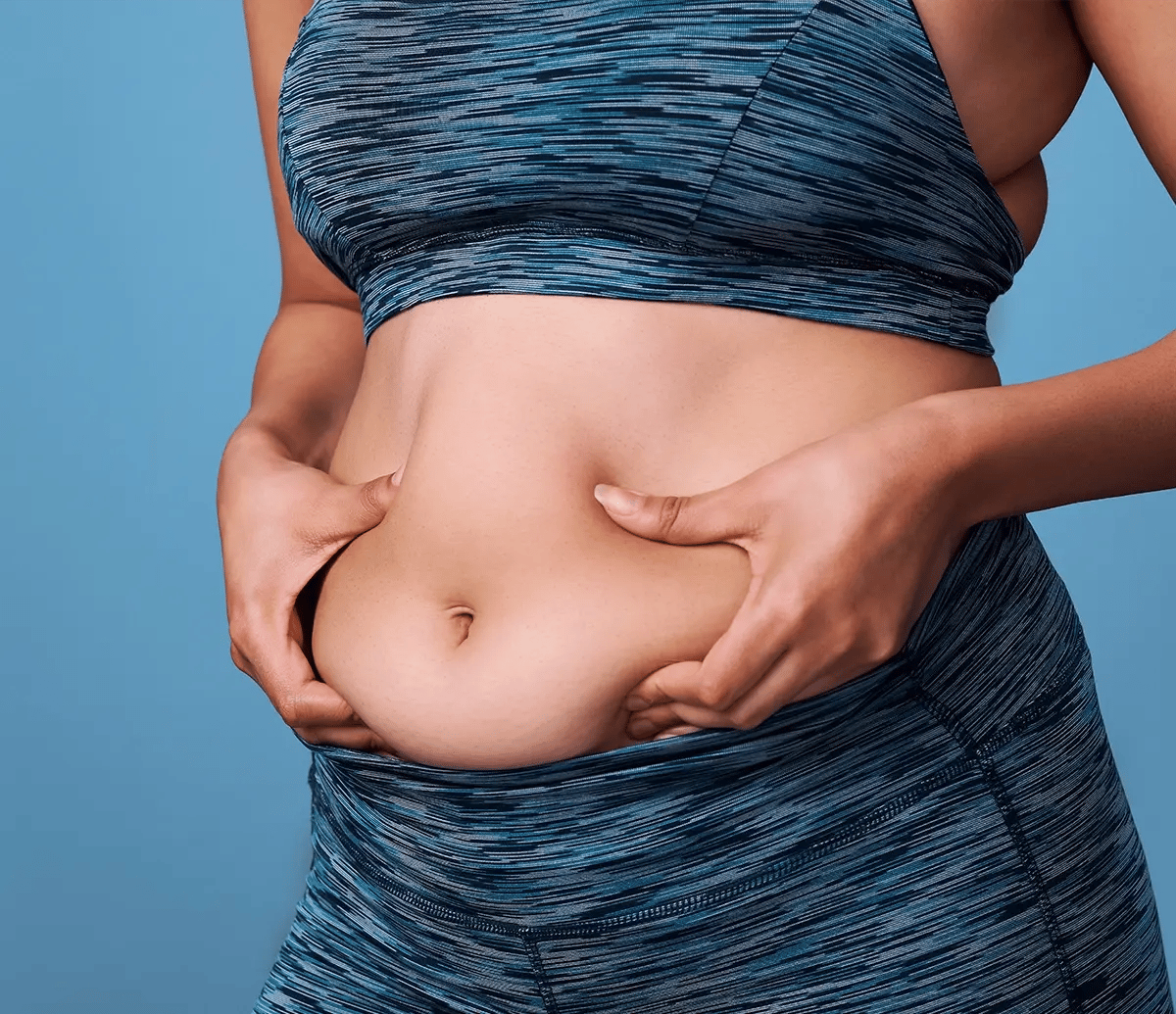 Woman pinching her belly before starting a GLP-1 weight loss program at Liquivida