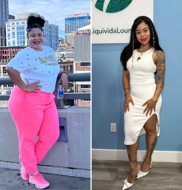 A woman's before and after going through the Liquivida GLP-1 weight loss program at Liquivida.