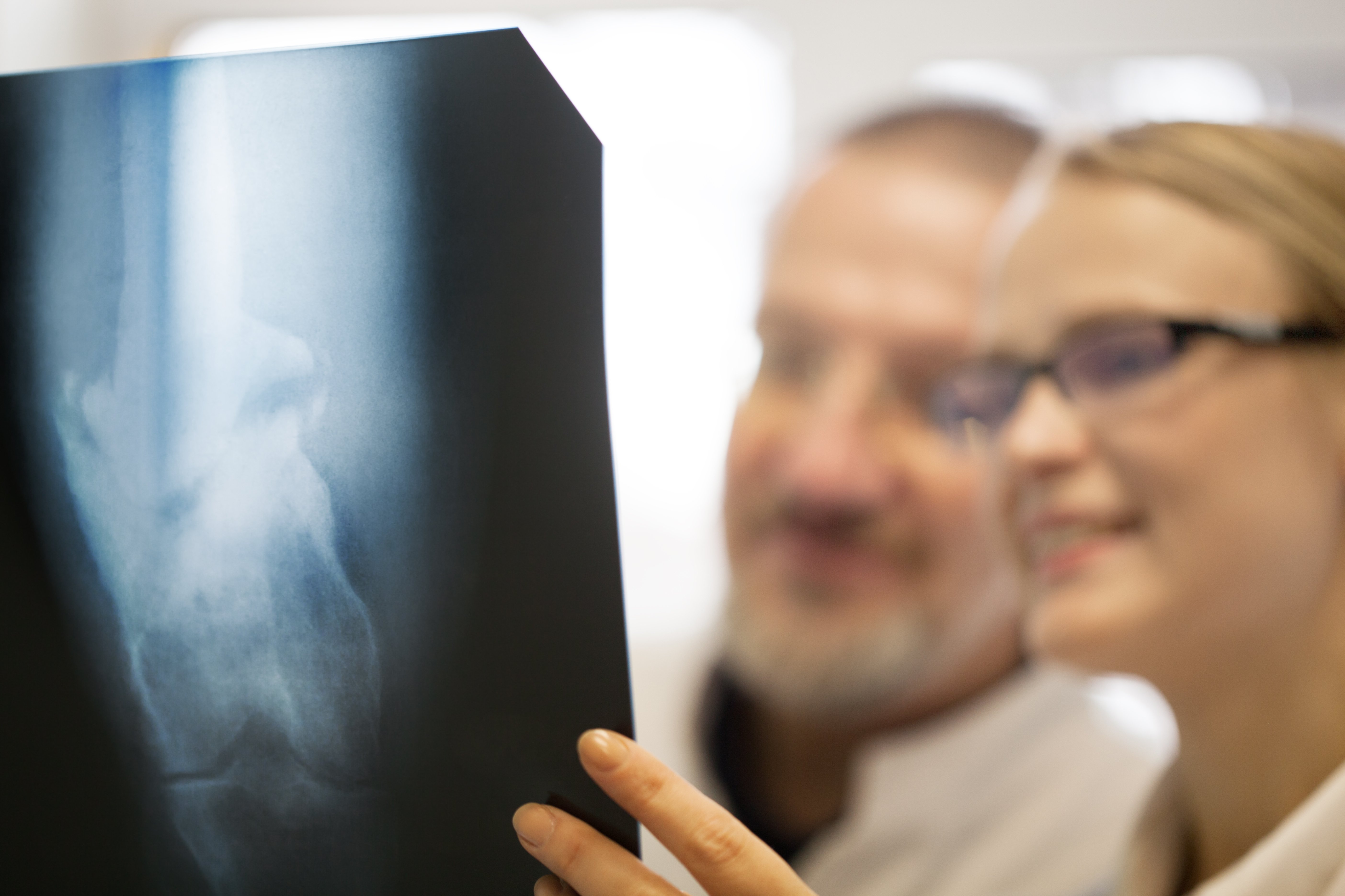 doctors-making-a-diagnosis-using-x-ray-images-SBI-300939041