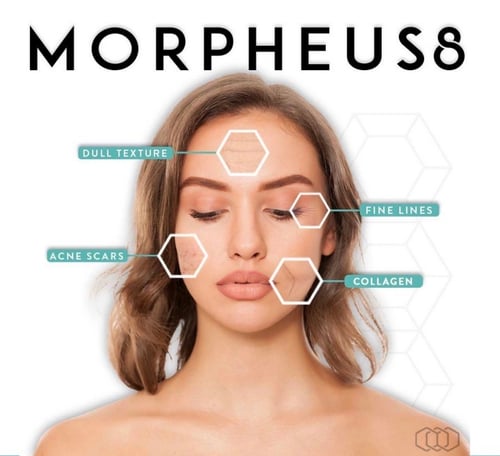 morpheus8-diagram