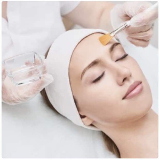 Chemical Peel